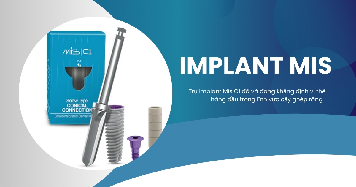 Trụ Implant Mis Của Nước Nào? Giá Bao Nhiêu Tiền?