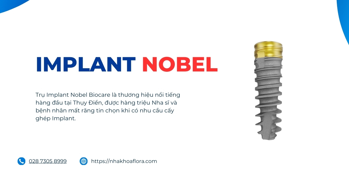 Implant Nobel của nước nào? Có tốt không? Giá bao nhiêu?