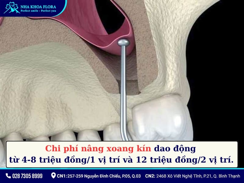 nâng xoang kín