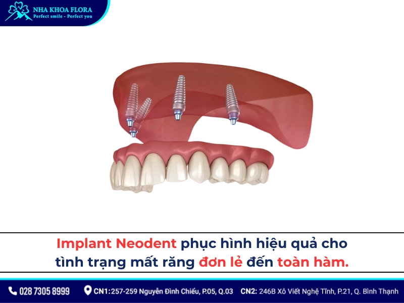 neodent