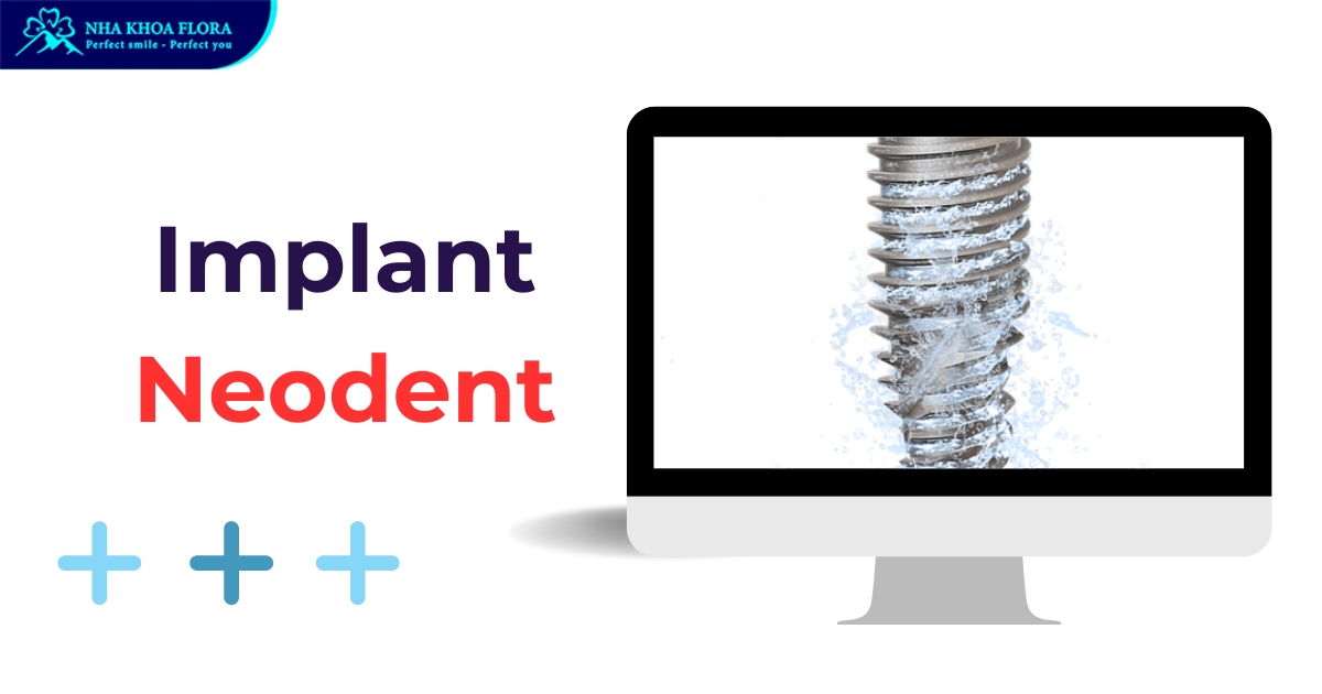 Neodent Implant của nước nào? Có tốt không? Giá bao nhiêu?