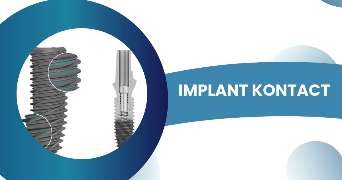 Trụ Implant Kontact có tốt hay không? Giá bao nhiêu tiền?