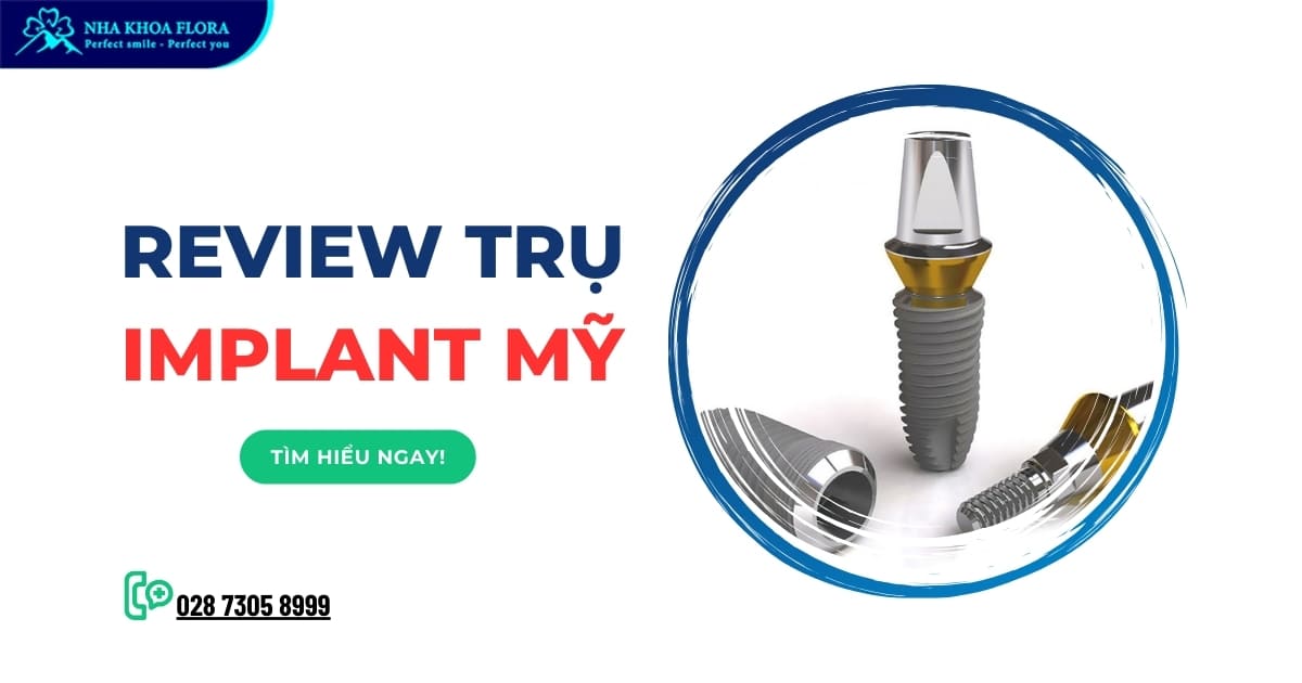 Trụ Implant Mỹ có tốt không? Top 3 loại được ưa chuộng nhất