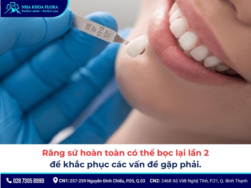 bọc răng sứ lần 2