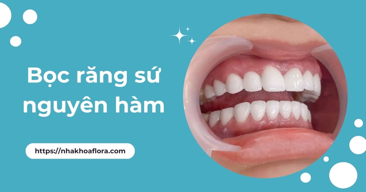 Bọc răng sứ nguyên hàm có tốt không? Giá bao nhiêu tiền?