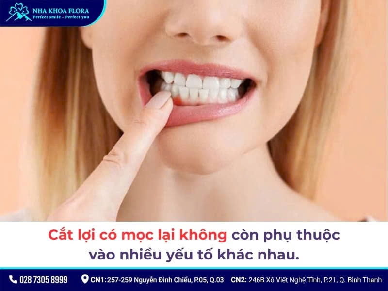 cắt lợi