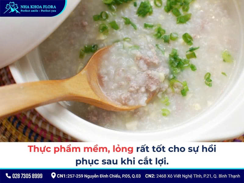 cắt lợi