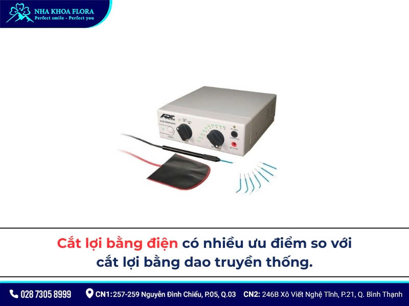 cắt lợi