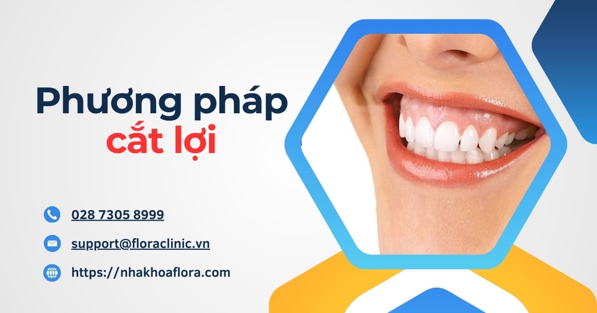 Cắt lợi là gì? Có đau không và những điều mà bạn cần biết