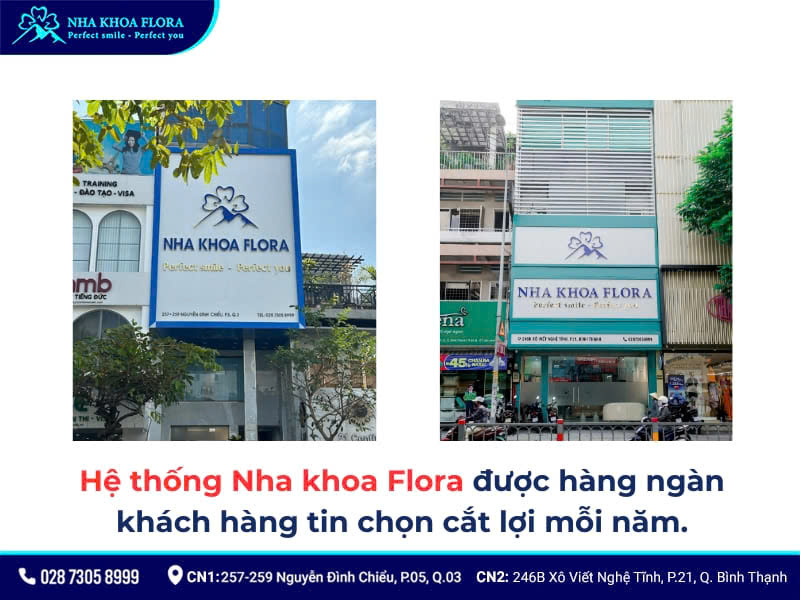 cắt lợi