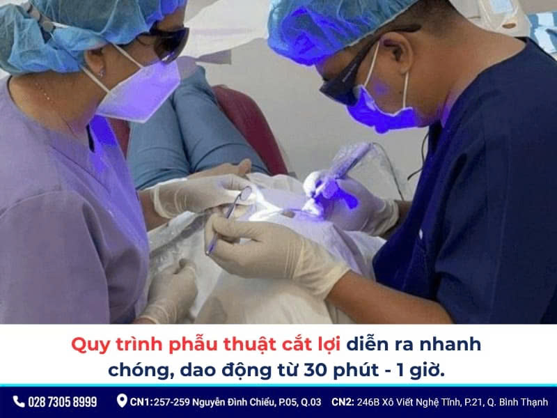 cắt lợi