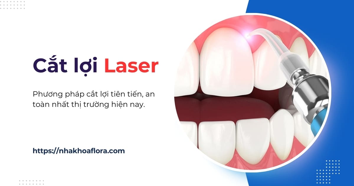 Cắt lợi Laser là gì? Có đau không? Chi phí bao nhiêu tiền?