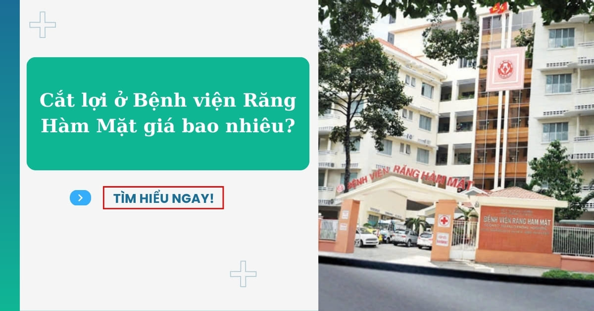 Cắt lợi ở Bệnh viện Răng Hàm Mặt tốt không? Giá bao nhiêu?