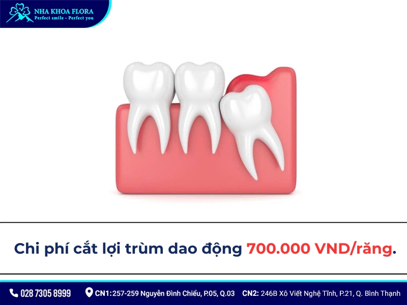 cắt lợi trùm
