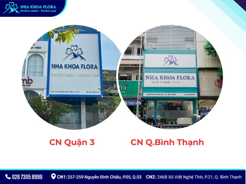 cầu răng sứ