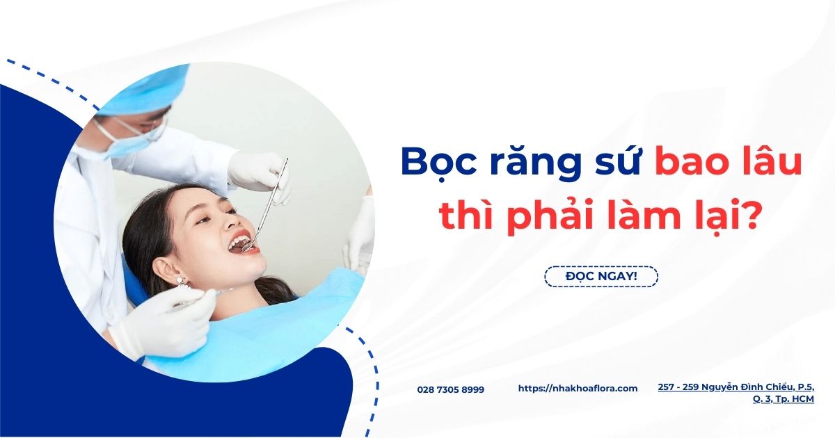 Bọc răng sứ bao lâu thì phải làm lại? Dấu hiệu cần thay mới