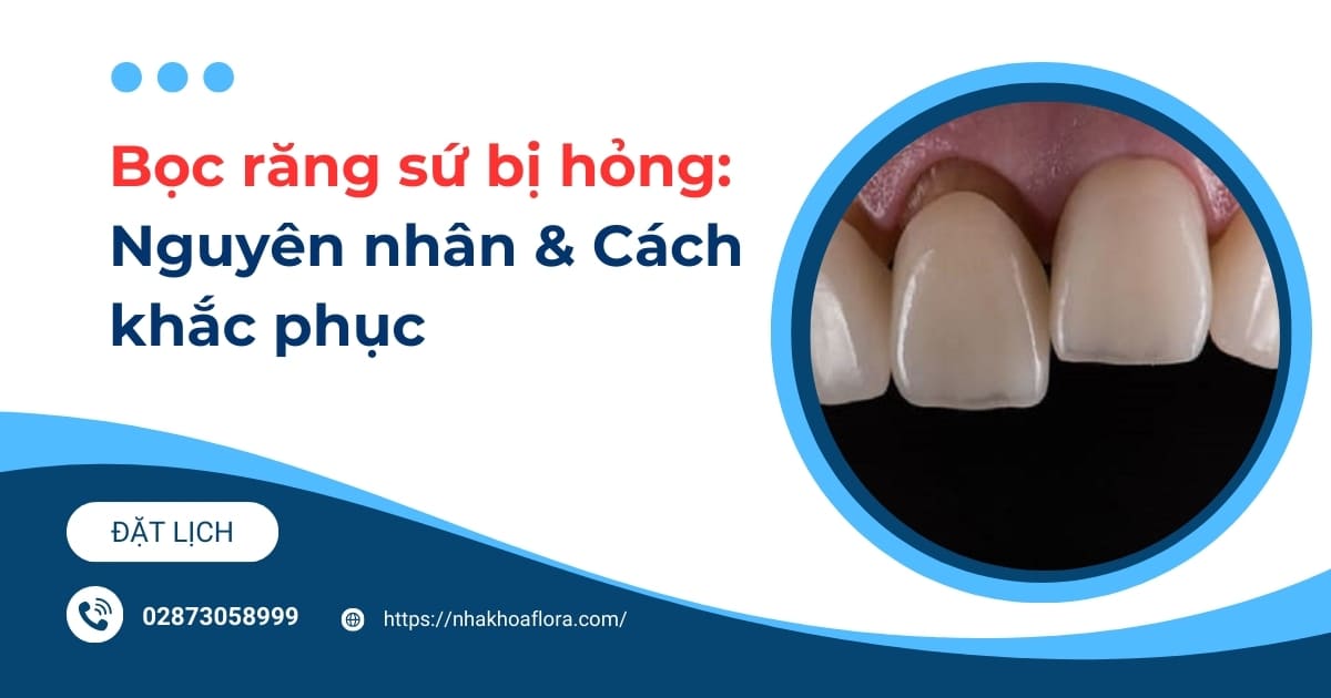 Bọc răng sứ bị hỏng do đâu? Cách khắc phục và phòng tránh