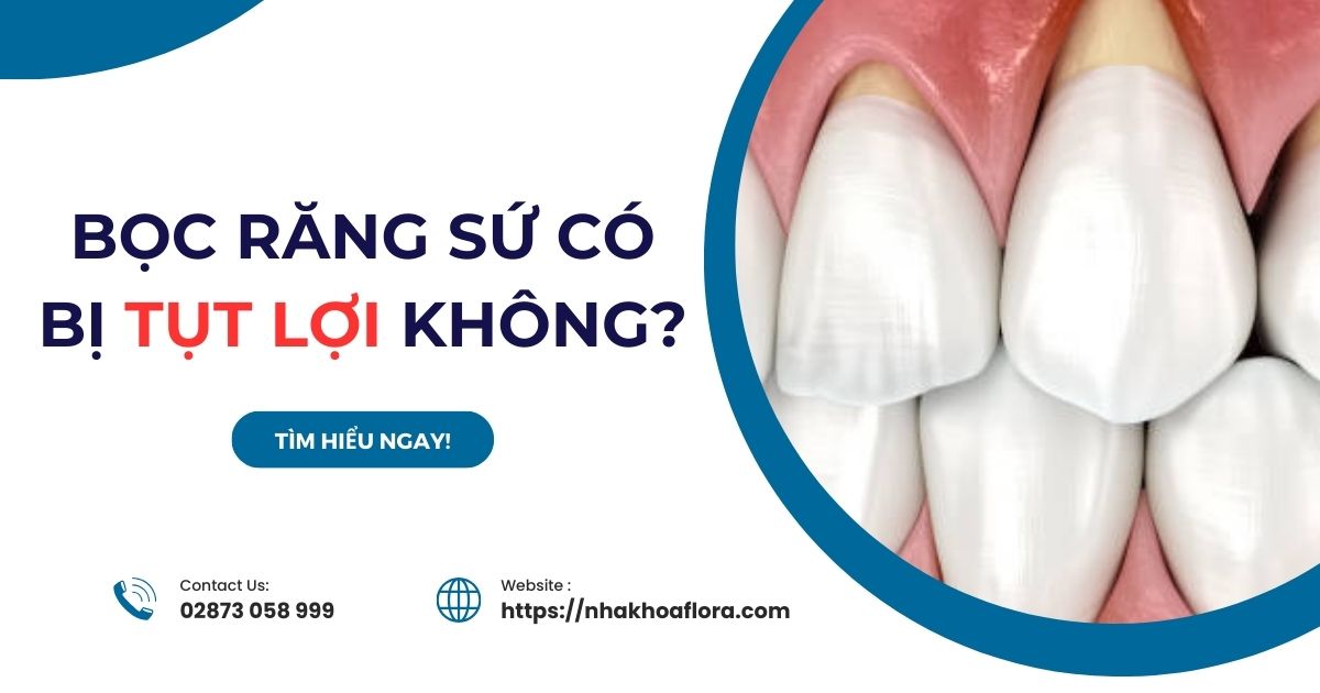 Bọc răng sứ có bị tụt lợi không? Cách khắc phục như thế nào?