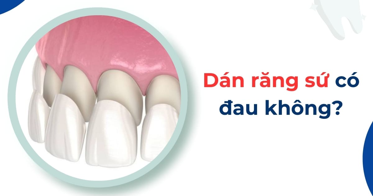 Dán Răng Sứ Có đau Không? Cách Hạn Chế đau Nhức Hiệu Quả