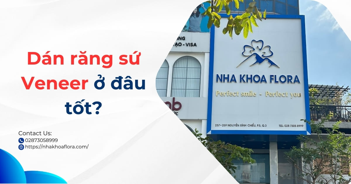 Dán Răng Sứ Veneer ở đâu Tốt? Cách Lựa Chọn địa Chỉ Uy Tín