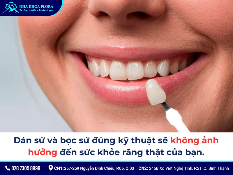 dán sứ và bọc sứ