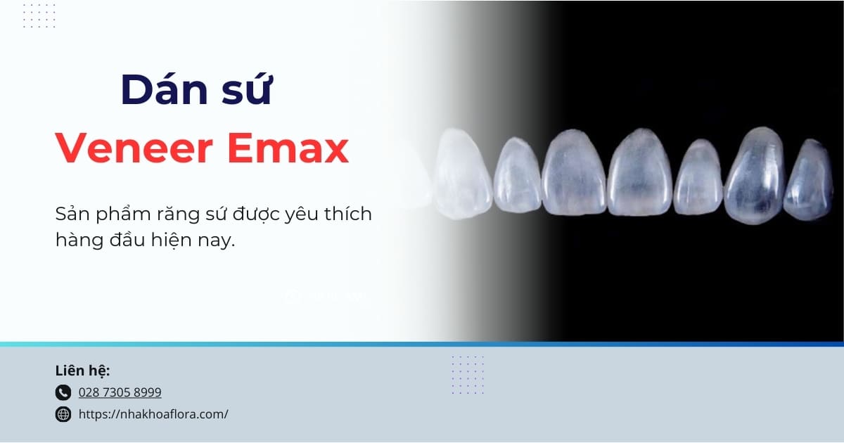 Dán sứ Veneer Emax có tốt không? Chi phí bao nhiêu tiền?
