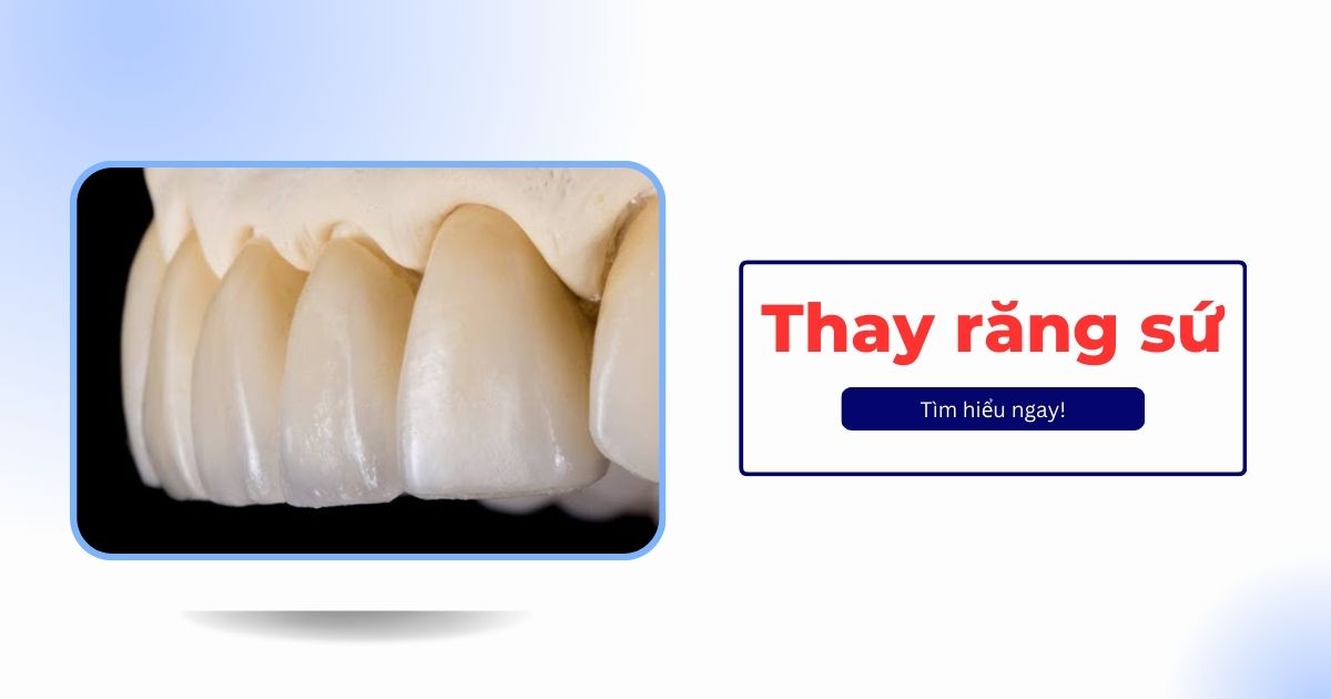 Thay răng sứ như thế nào? Có đau không? Giá bao nhiêu tiền?