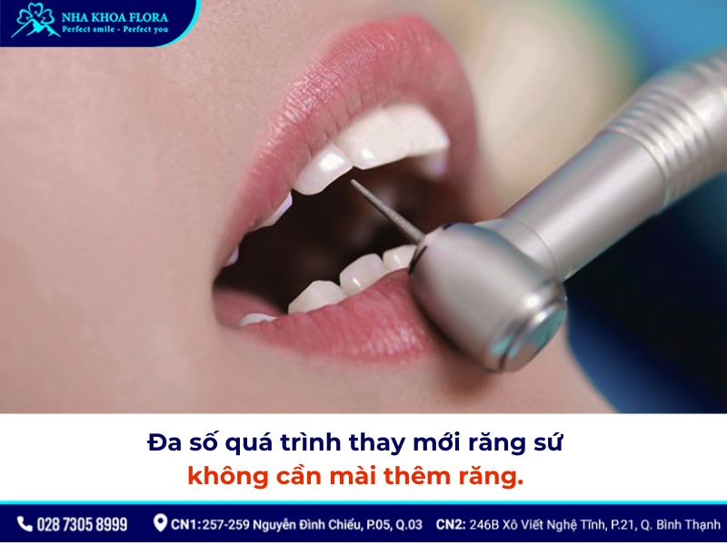 thay răng sứ