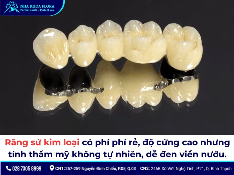bọc răng sứ
