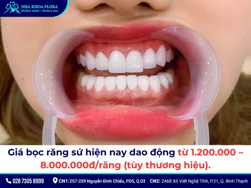 bọc răng sứ