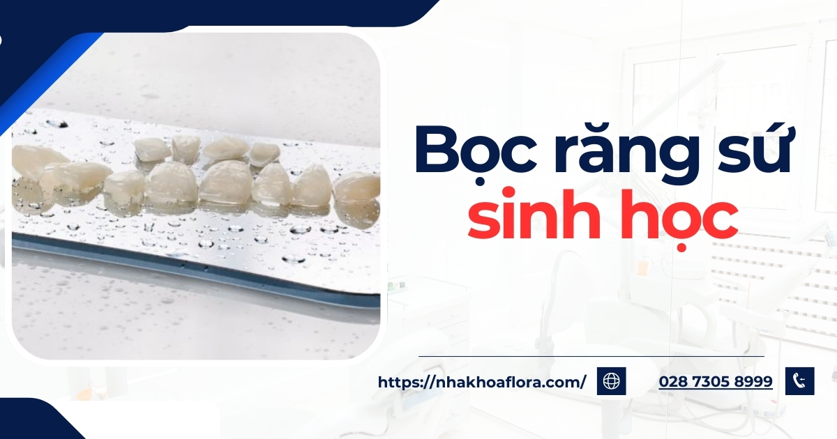 Bọc răng sứ sinh học là gì? Có tốt không? Các bước thực hiện