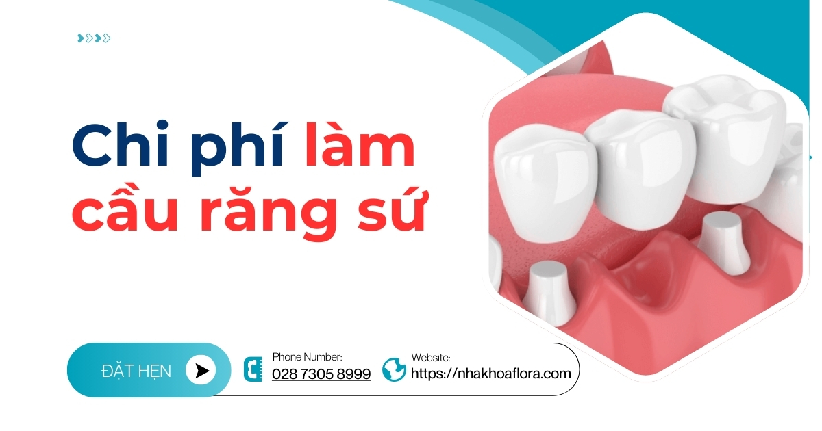 Chi phí làm cầu răng sứ bao nhiêu? Bảng giá cầu răng sứ