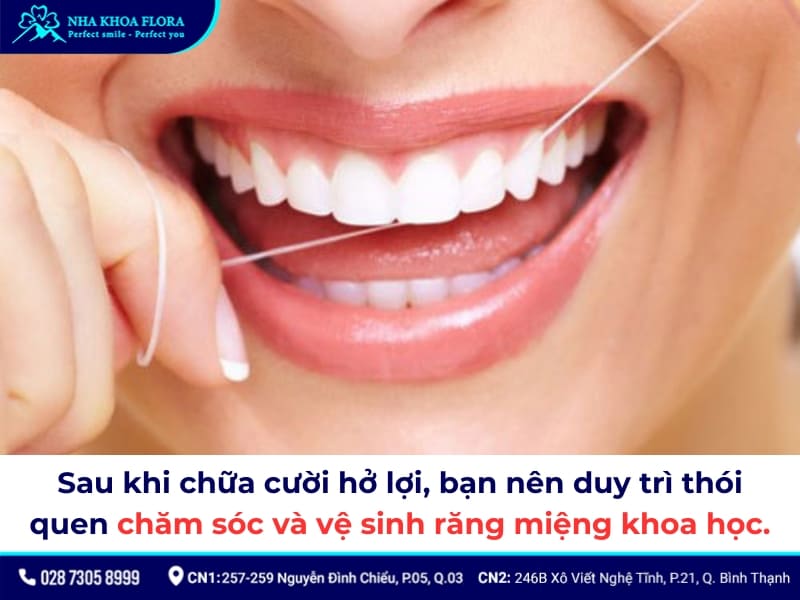 cười hở lợi
