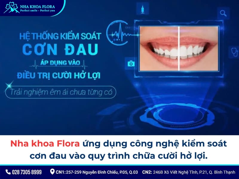cười hở lợi