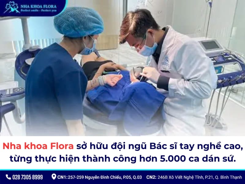 dán sứ veneer