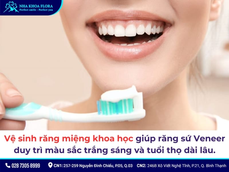 dán sứ veneer