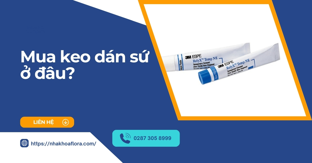 Mua keo dán sứ ở đâu tốt? Có mấy loại? Giá bao nhiêu tiền?