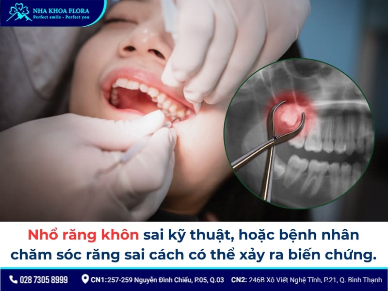 nhổ răng khôn