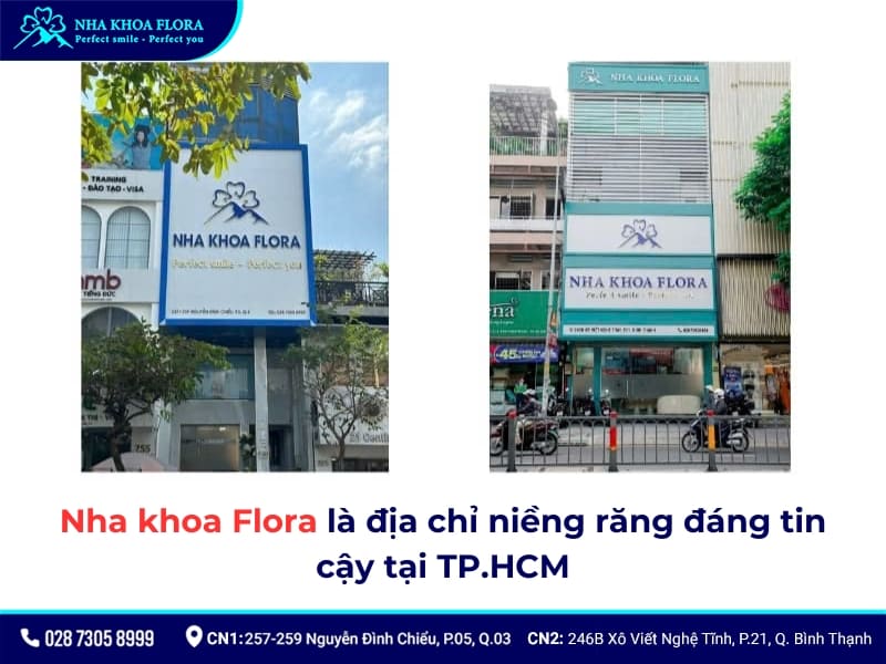 niềng răng bao nhiêu tiền
