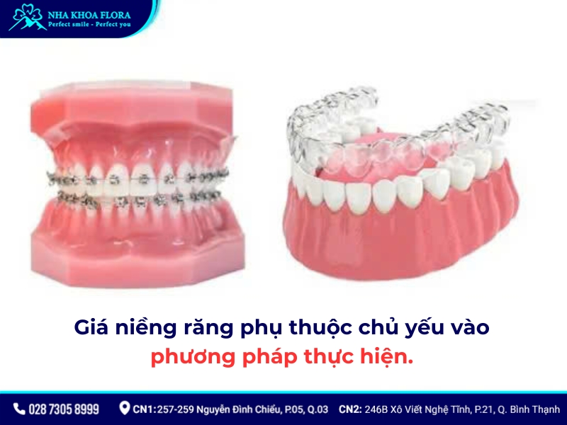 niềng răng bao nhiêu tiền