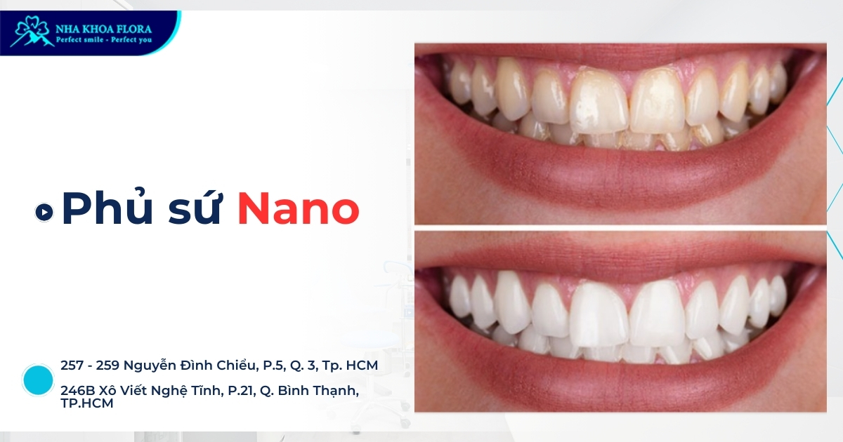 Phủ sứ Nano là gì, giá bao nhiêu và các vấn đề bạn nên biết!