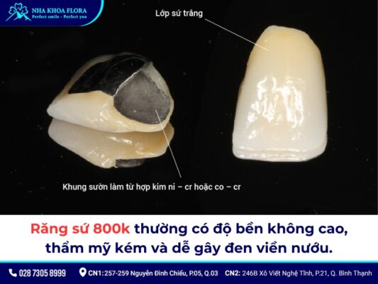 Răng sứ 800k - ảnh 2 Răng sứ 800k - ảnh 2