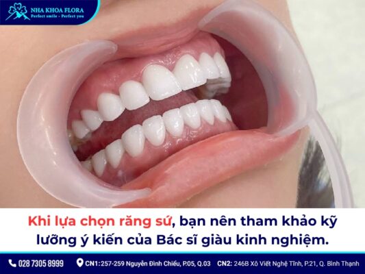 Răng sứ 800k - ảnh 4 Răng sứ 800k - ảnh 4