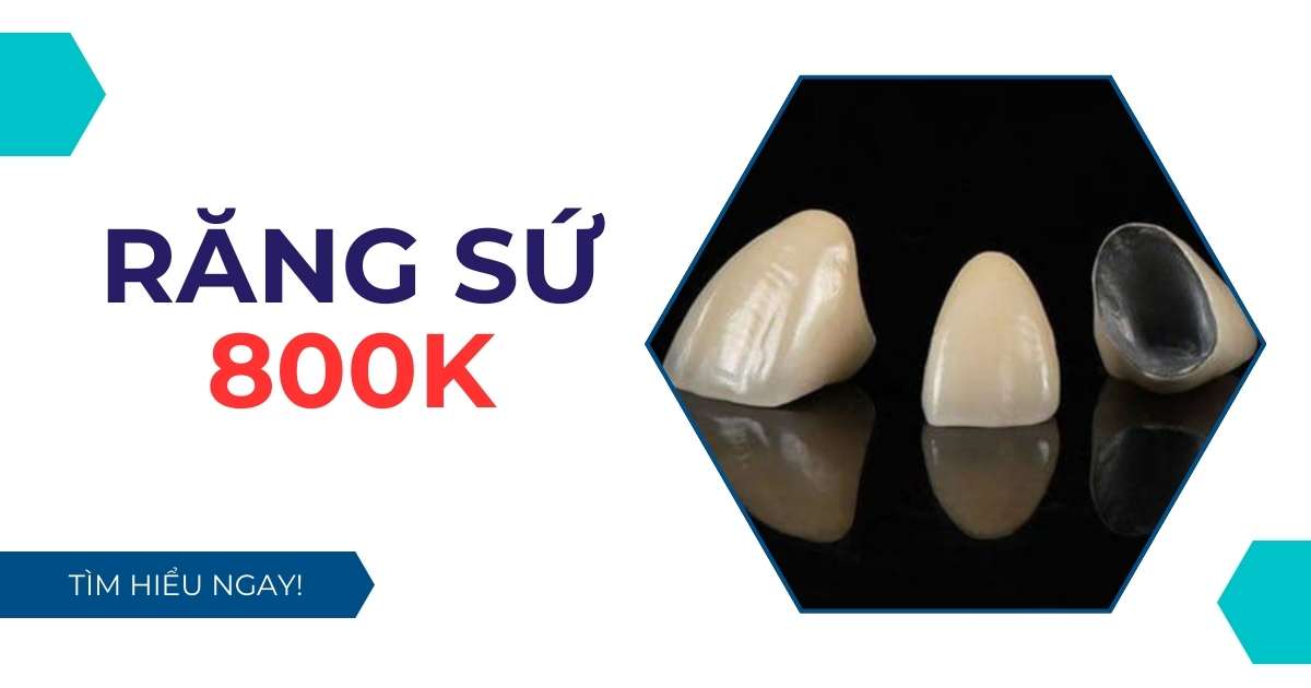 Răng sứ 800k có đảm bảo chất lượng không? Có nên lựa chọn?
