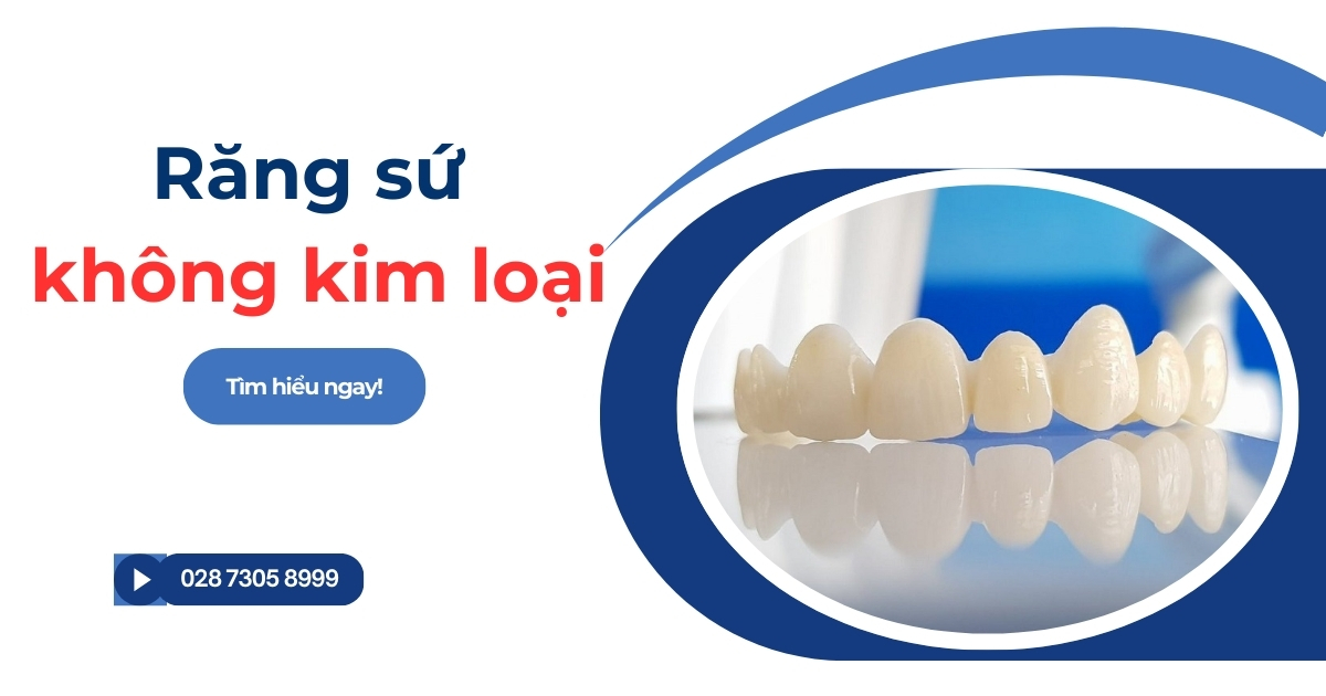 Răng sứ không kim loại là gì? Có tốt không? Giá bao nhiêu?