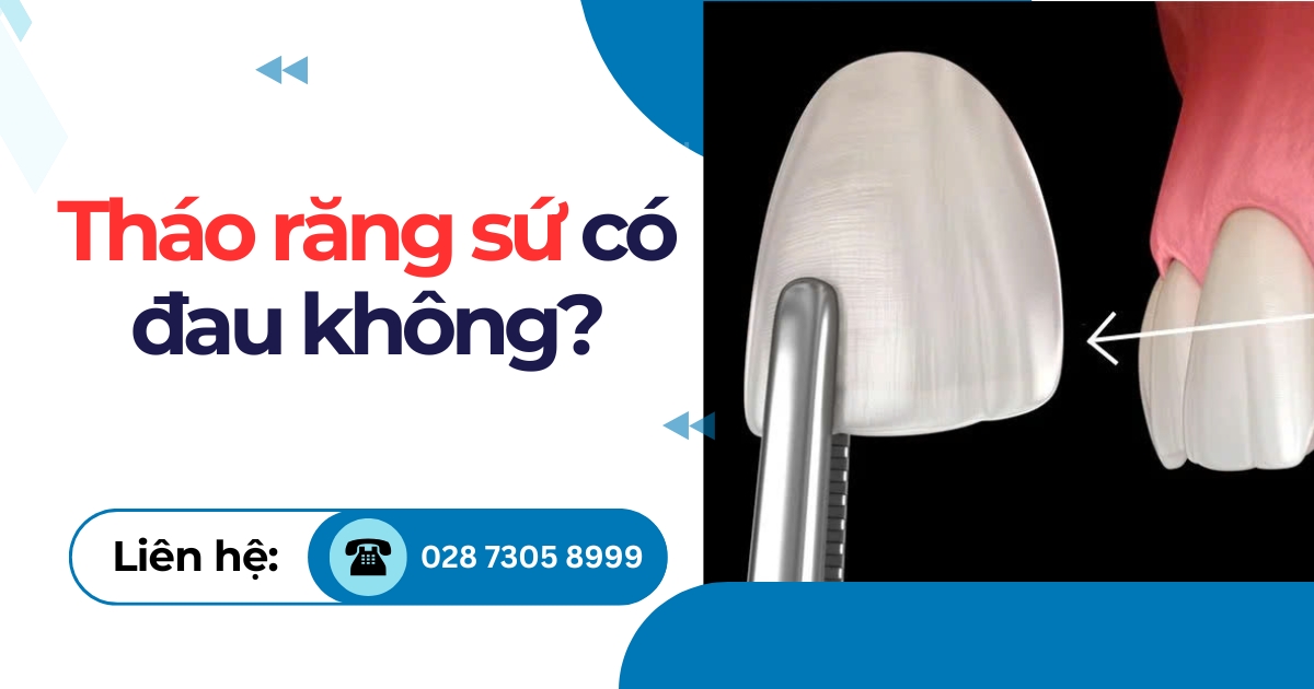 Tháo răng sứ có đau không? Khi nào cần tháo ra và bọc lại?