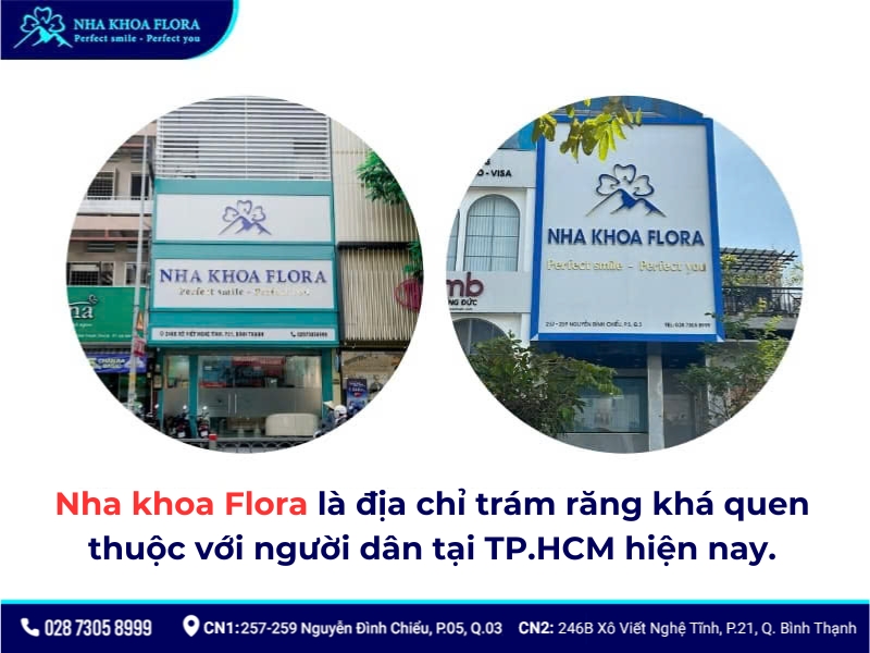 Trám răng tại Nha khoa Flora bạn hoàn toàn có thể an tâm, bởi đội ngũ Bác sĩ hơn 10 năm kinh nghiệm sẽ trực tiếp khám và điều trị