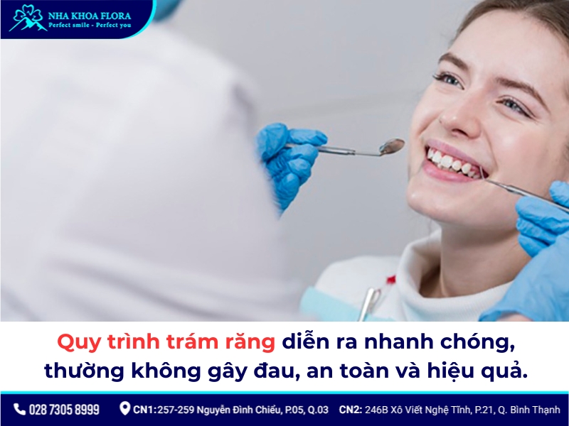 Trám răng là một kỹ thuật nha khoa đơn giản, diễn ra nhanh chóng và đảm bảo an toàn