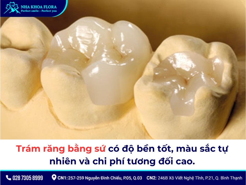 Trám răng bằng sứ có màu sắc tự nhiên như răng thật, độ bền cao nên được nhiều người lựa chọn