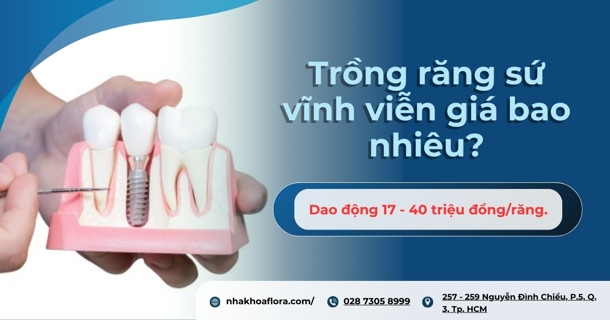 Trồng răng sứ vĩnh viễn giá bao nhiêu? Bảng giá mới nhất